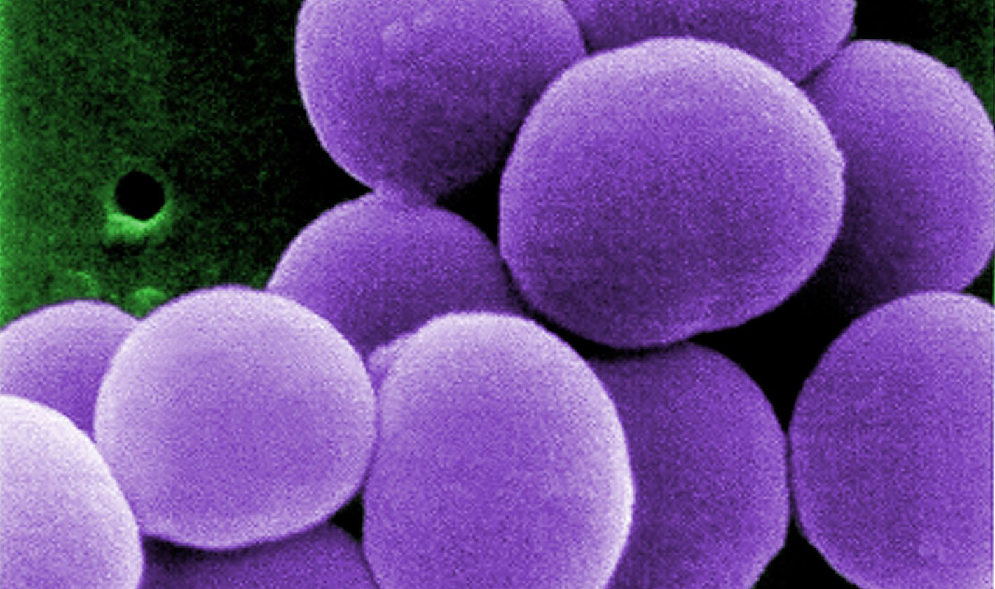 Staphylococcus_aureus